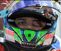 felipe-massa-helmet-after-crash